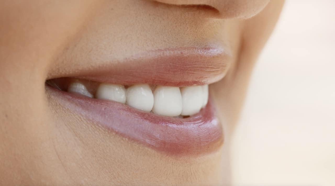 Comment les gouttières transparentes ont-elles révolutionné l’orthodontie ?