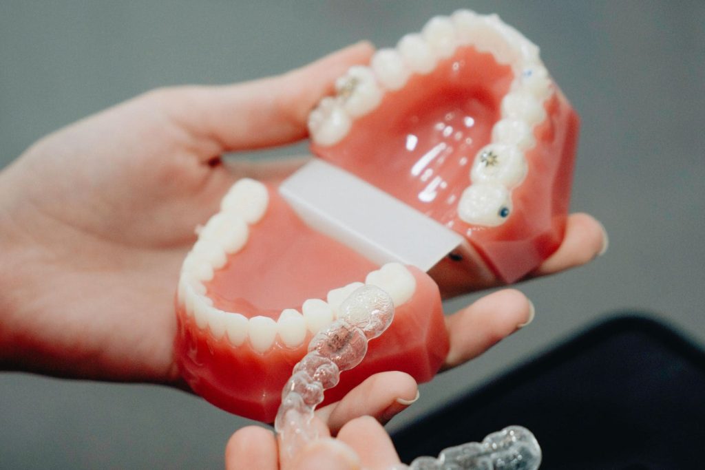 Gouttières transparentes - Dr Isabelle Skarbek Borowski