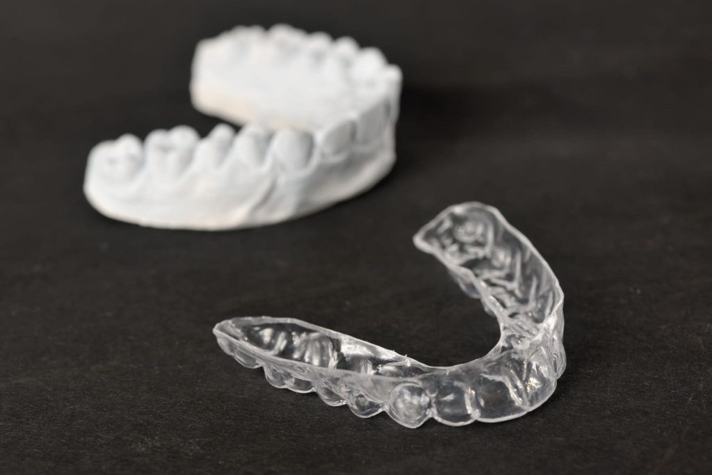 Appareils de contention orthodontique à Lille