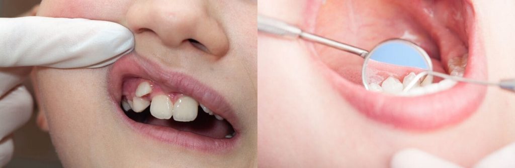 Déroulement de la première visite chez l’orthodontiste